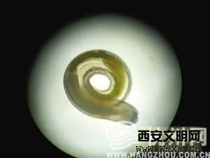 什么是颚口线虫