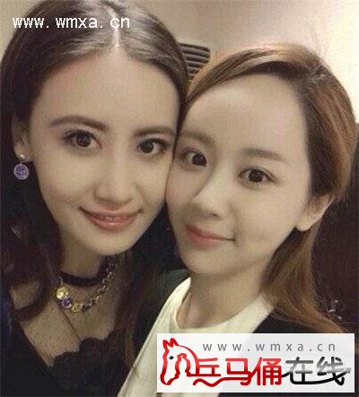 杨紫个人资料简介 杨紫整容前后对比照