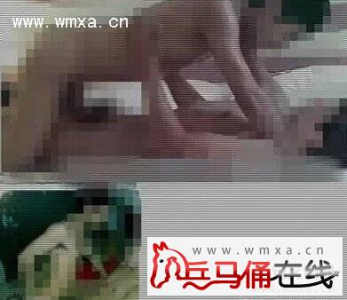 梓骁肛裂_朱梓骁肛裂视频_朱梓骁肛裂事件 - 图