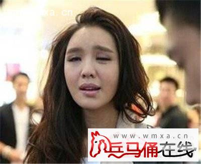 官恩娜个人资料简介官恩娜面瘫症照片曝光