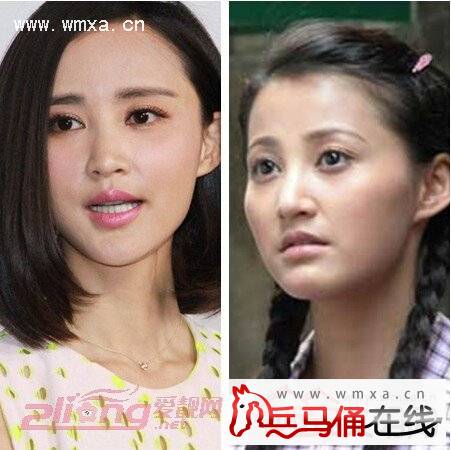 张歆艺整容前后照片对比 张歆艺个人资料及家