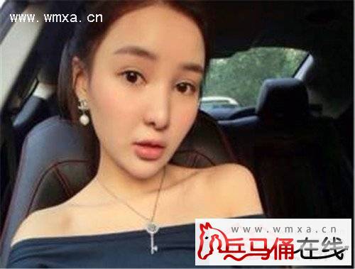 郭美美整容前后照片对比炫富事件视频直播内幕