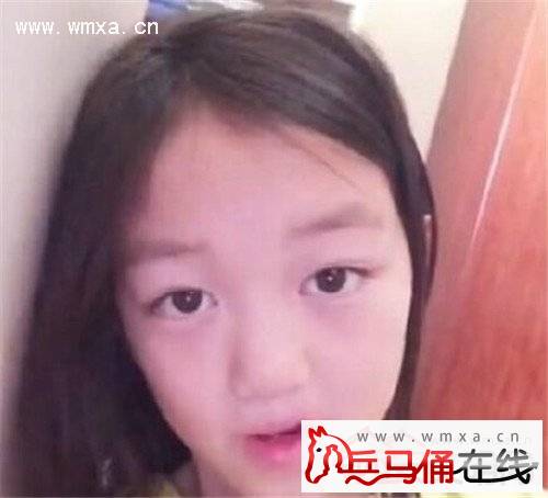 王菲女儿李嫣兔唇原因及修复对比图 李嫣美拍