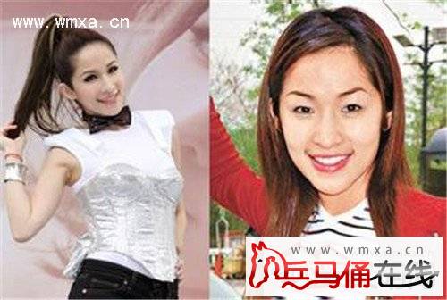 萧亚轩整容前后对比照片 揭秘萧亚轩遭软禁是