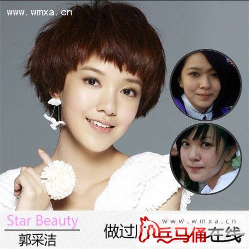 洁整容前后照片硅胶脸吓人 回应称脸部肌肉失